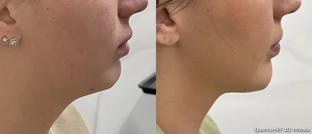 The Luxe Medspa Aesthetics & Bodycare result — Upper Arlington, OH