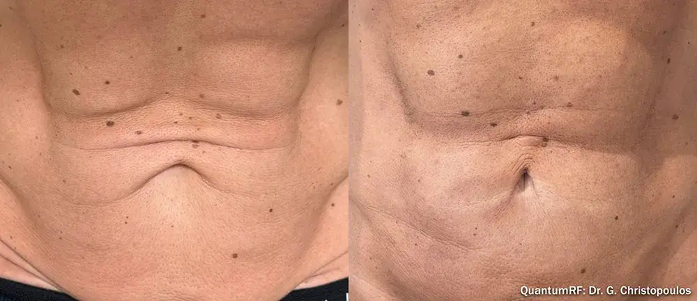 The Luxe Medspa Aesthetics & Bodycare result — Upper Arlington, OH