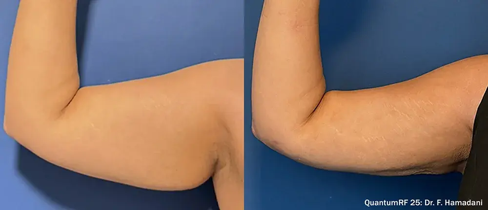 The Luxe Medspa Aesthetics & Bodycare result — Upper Arlington, OH