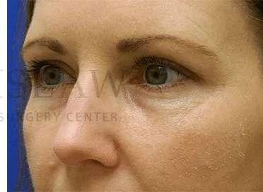 Facelift Conneticut: Dr. Paul Stanislaw provider photo