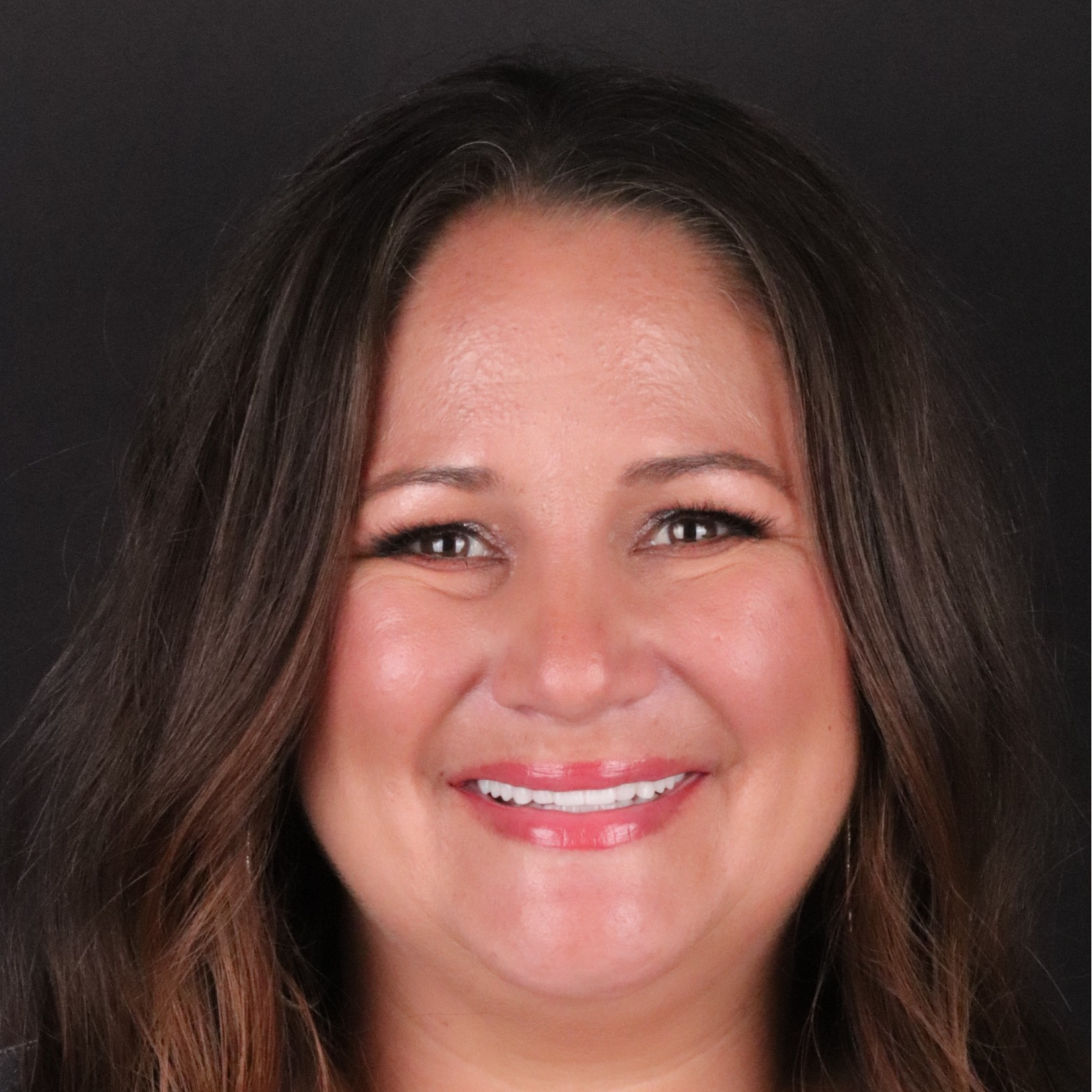 The Practice: Dr. Matt Kasiar, DMD | Franklin, TN smile makeover after — Franklin, TN
