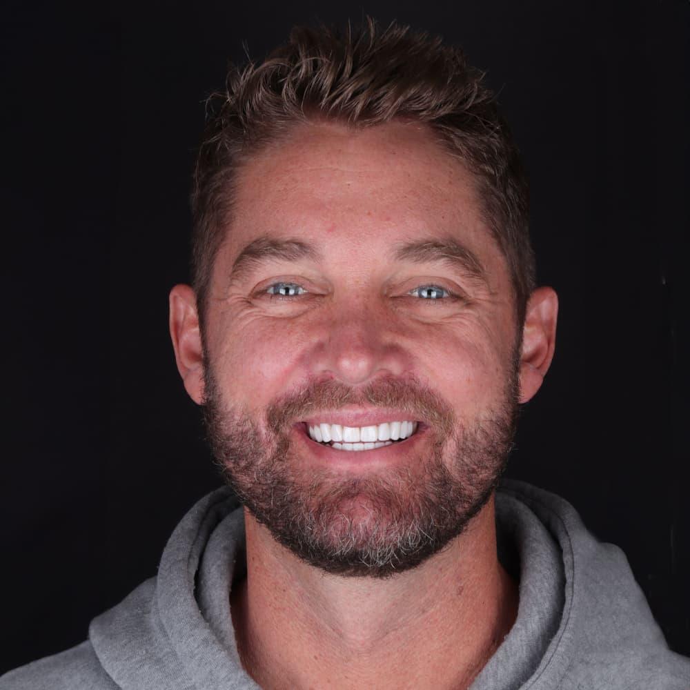 The Practice: Dr. Matt Kasiar, DMD | Franklin, TN smile makeover after — Franklin, TN