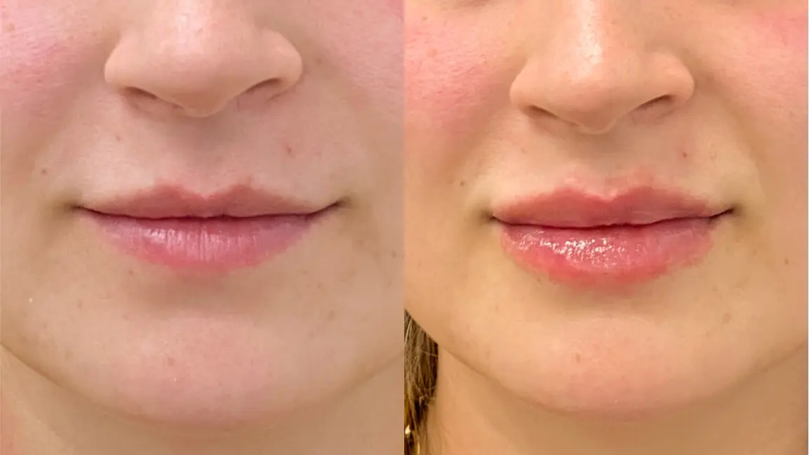 Dr. Ann Aesthetics result — Edina, MN