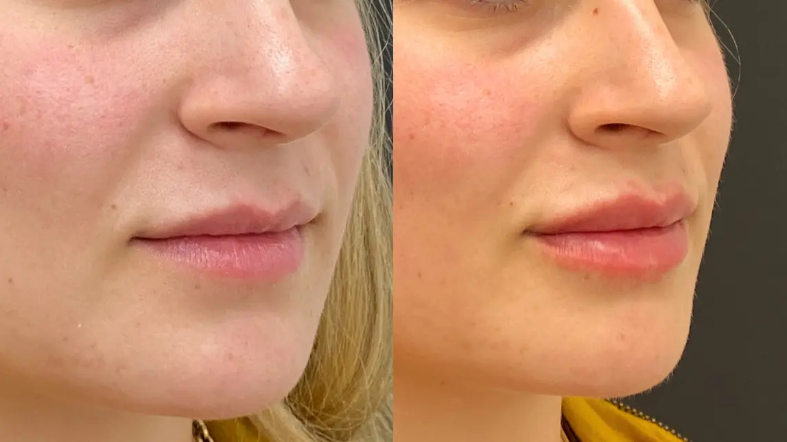 Dr. Ann Aesthetics result — Edina, MN