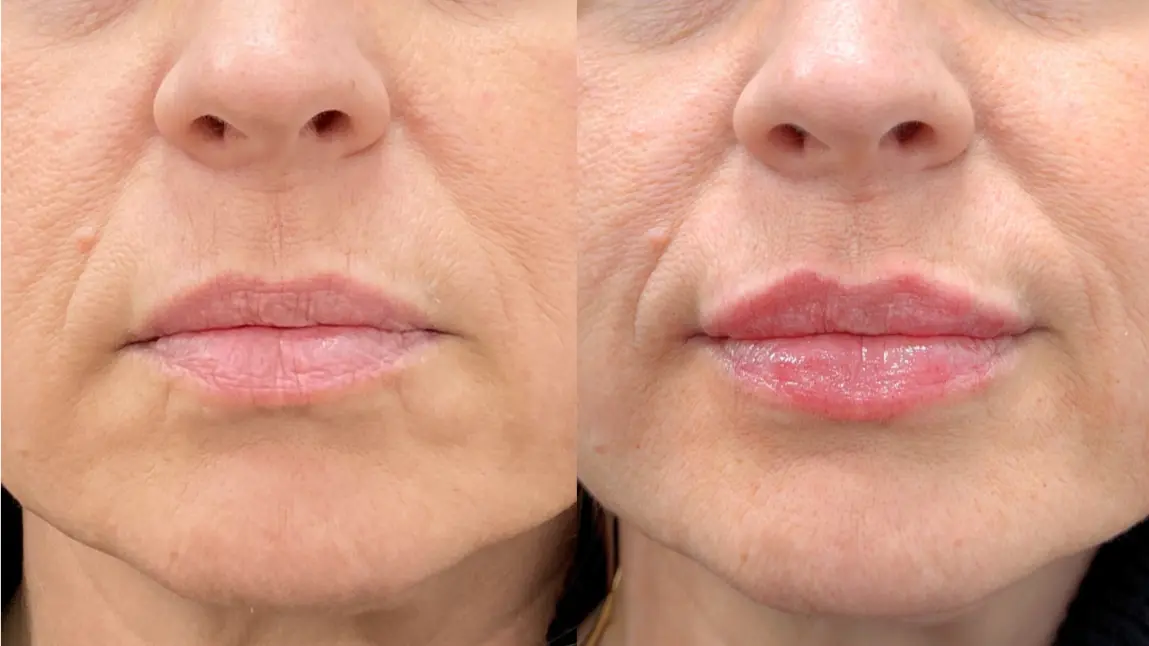 Dr. Ann Aesthetics result — Edina, MN