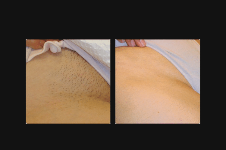 Bright Esthetics & Body Wellness result — Manchester, NH