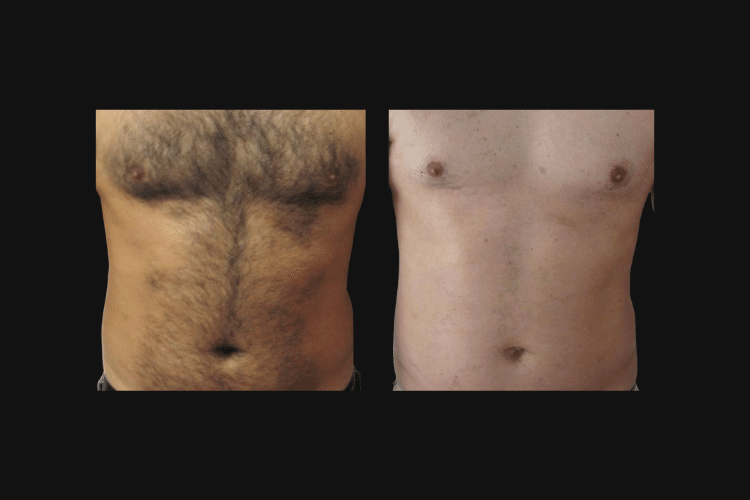 Bright Esthetics & Body Wellness result — Manchester, NH