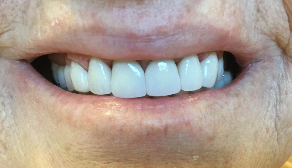 Corry Dental result — Cedar City, UT