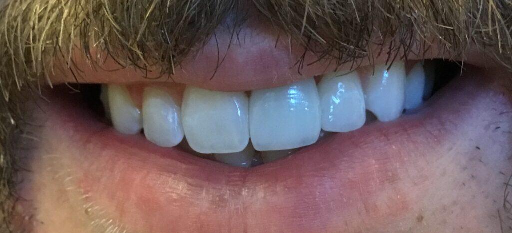 Corry Dental result — Cedar City, UT