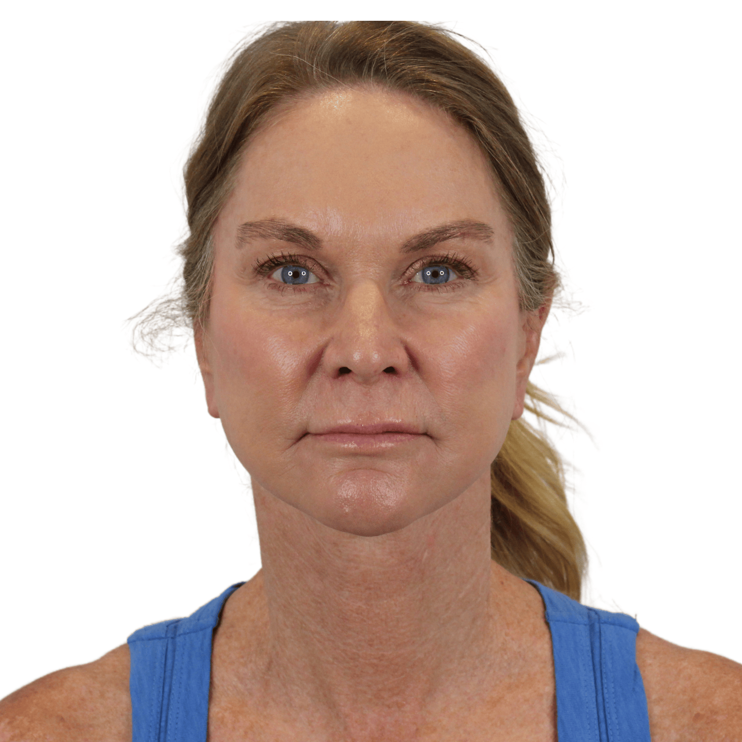 AdmireMD Plastic Surgery + Skin Clinic after — Scottsdale, AZ
