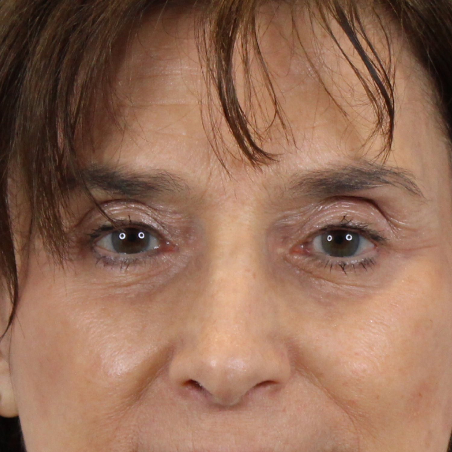 AdmireMD Plastic Surgery + Skin Clinic after — Scottsdale, AZ