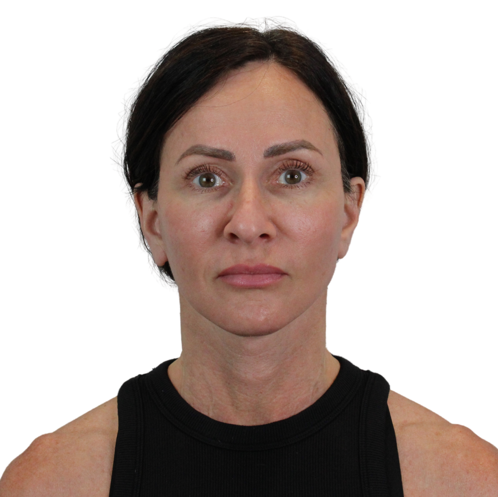 AdmireMD Plastic Surgery + Skin Clinic after — Scottsdale, AZ