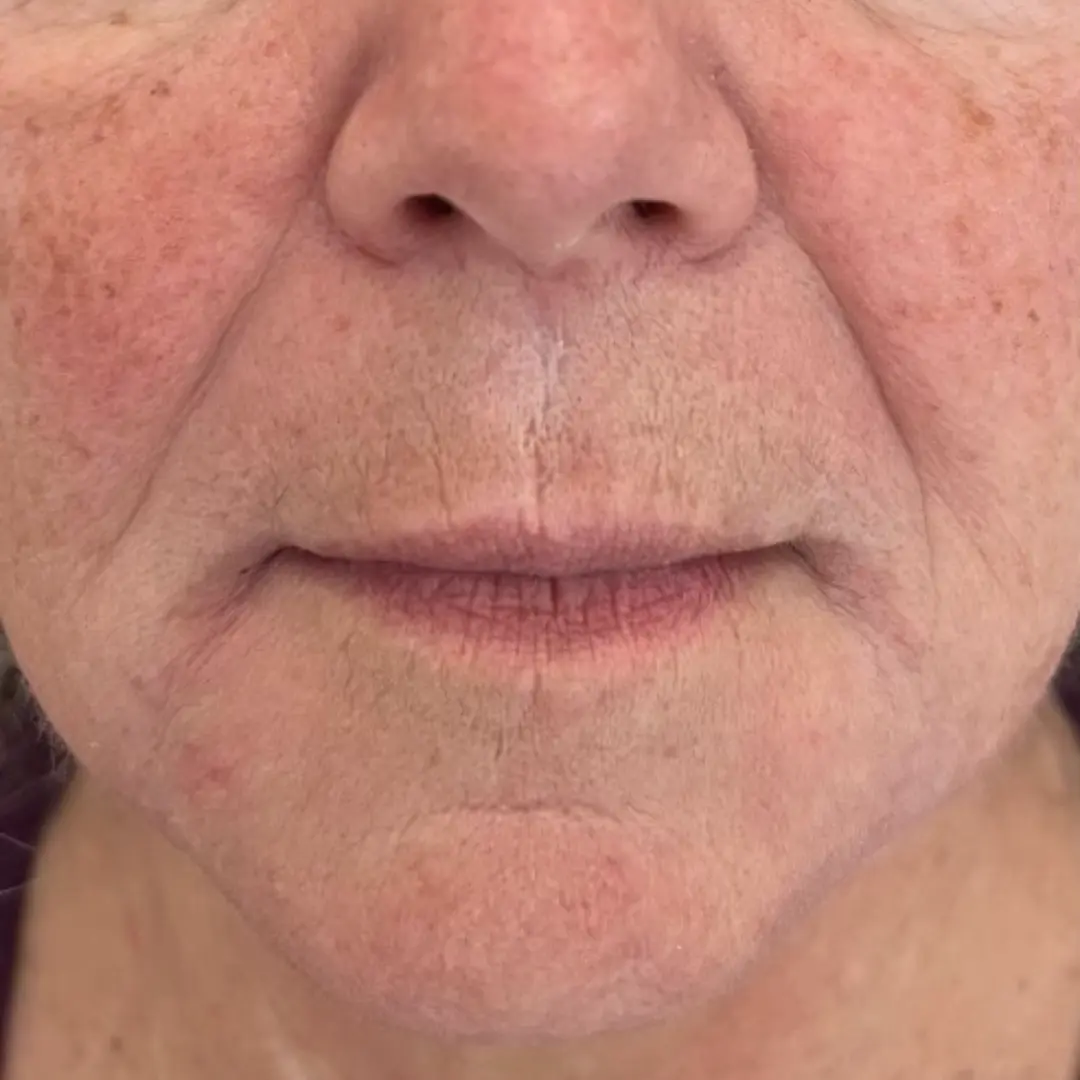 House of Aesthetics after — Cary, NC