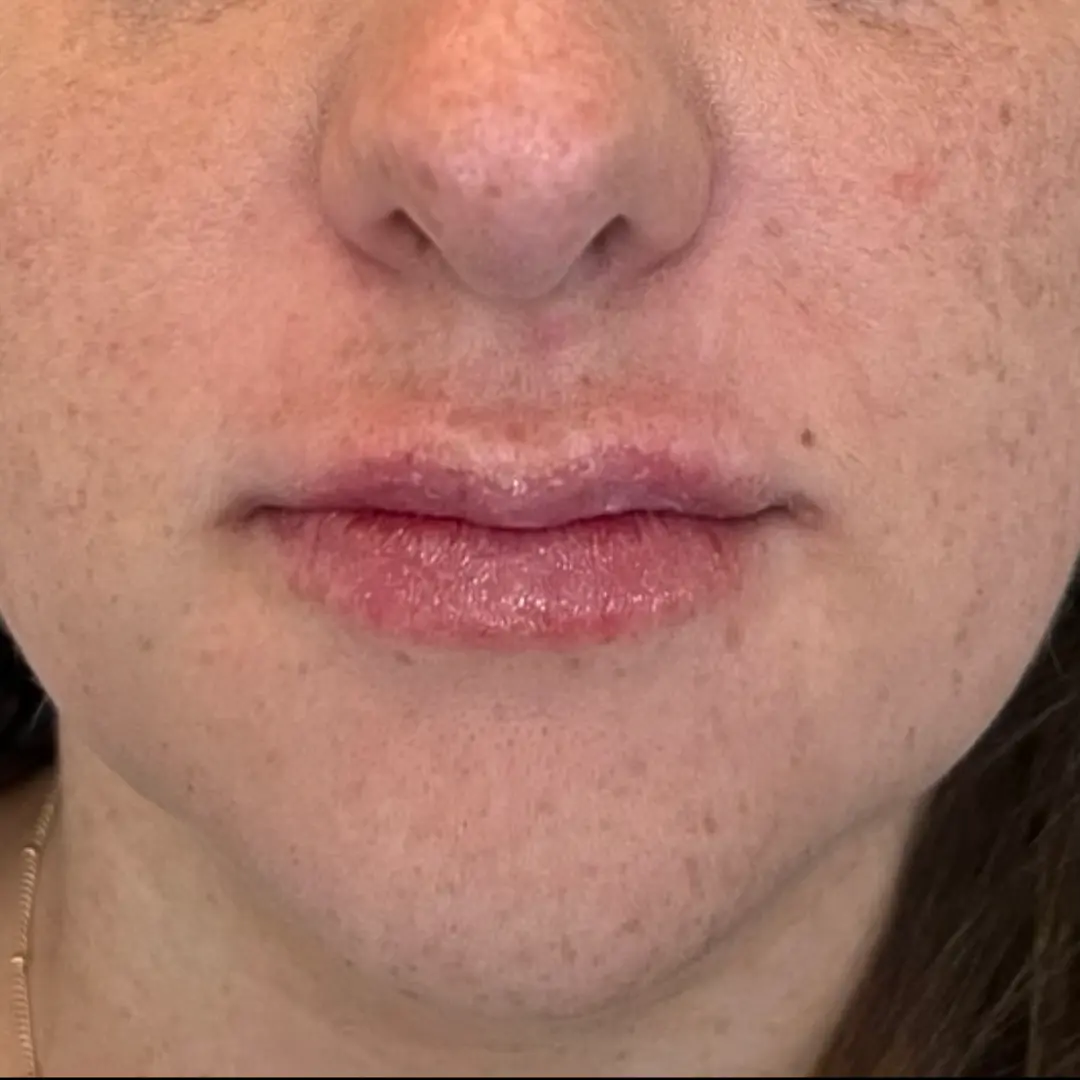 House of Aesthetics after — Cary, NC