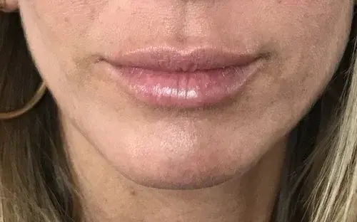 House of Aesthetics after — Cary, NC