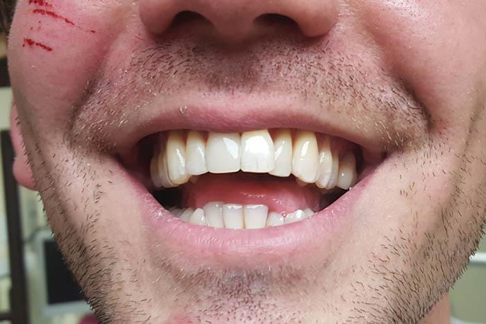 Holladay Smiles after — Salt Lake City, UT