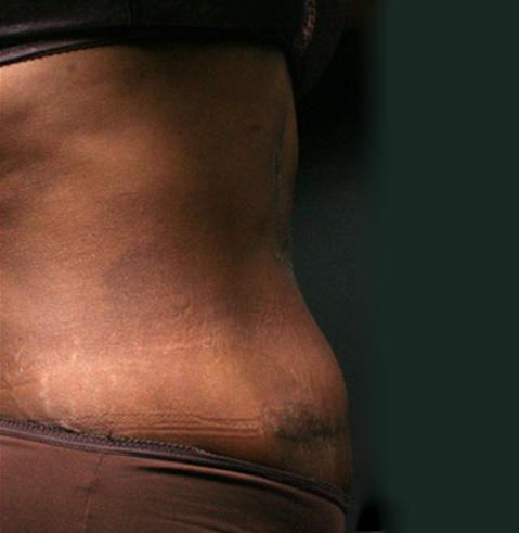 Dr. Tambra R. Garrett, MD, Fort Worth provider photo