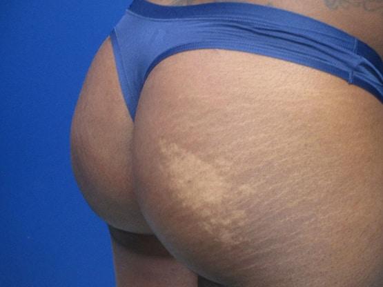 Dr. Tambra R. Garrett, MD, Fort Worth bbl after — Fort Worth, TX