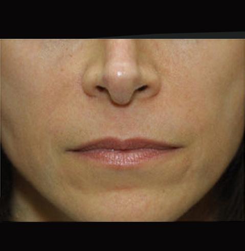 Dr. Tambra R. Garrett, MD, Fort Worth after — Fort Worth, TX