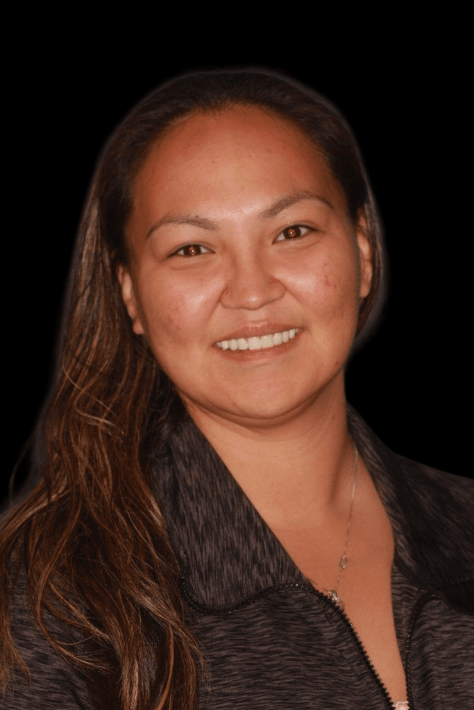 Lasting Smiles Dental Implant Center dental implants after — Irvine, CA