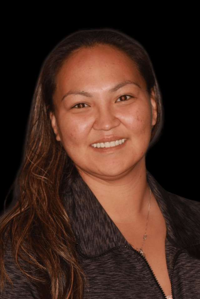 Dental Implants after at Lasting Smiles Dental Implant Center in Irvine, CA