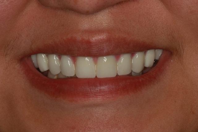 Lasting Smiles Dental Implant Center provider photo