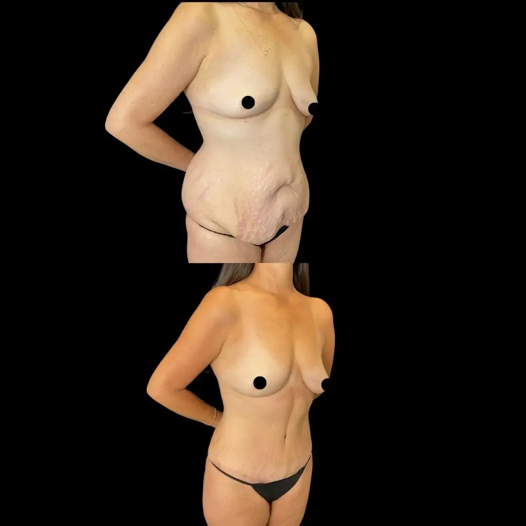 Real You Plastic Surgery result — American Fork, UT