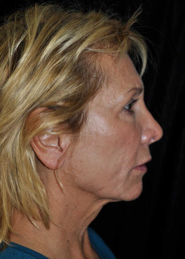 Plastic Surgery, Pittsburgh PA: Dr. Anna Wooten, Beleza Plastic Surgery & Med Spa provider photo