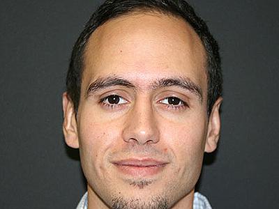 Dr. Sukkar otoplasty after — Houston, TX