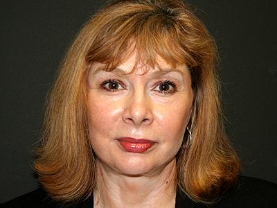 Dr. Sukkar facelift after — Houston, TX