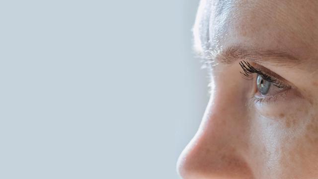 Blepharoplasty result at Shah Aesthetic Surgery - Rhinoplasty and Facelift Specialist in Englewood, CO