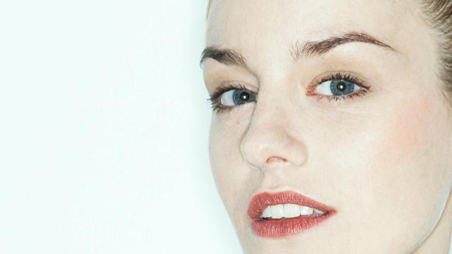 Brow Lift result at Shah Aesthetic Surgery - Rhinoplasty and Facelift Specialist in Englewood, CO
