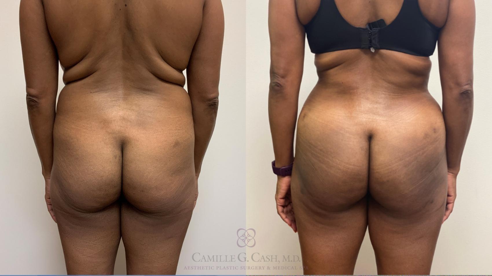 Camille Cash, MD bbl result — Houston, TX