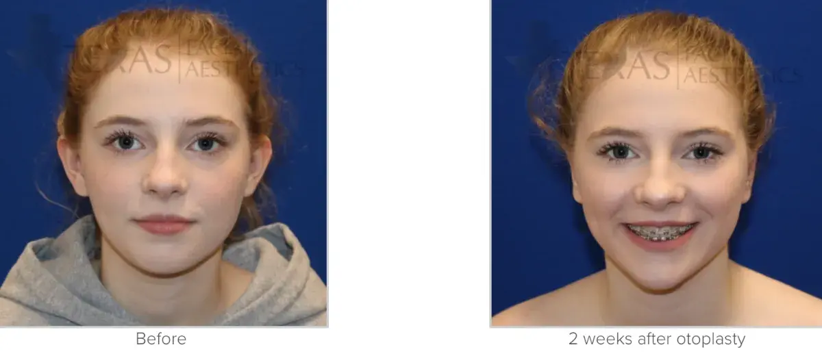 Texas Facial Aesthetics result — Frisco, TX