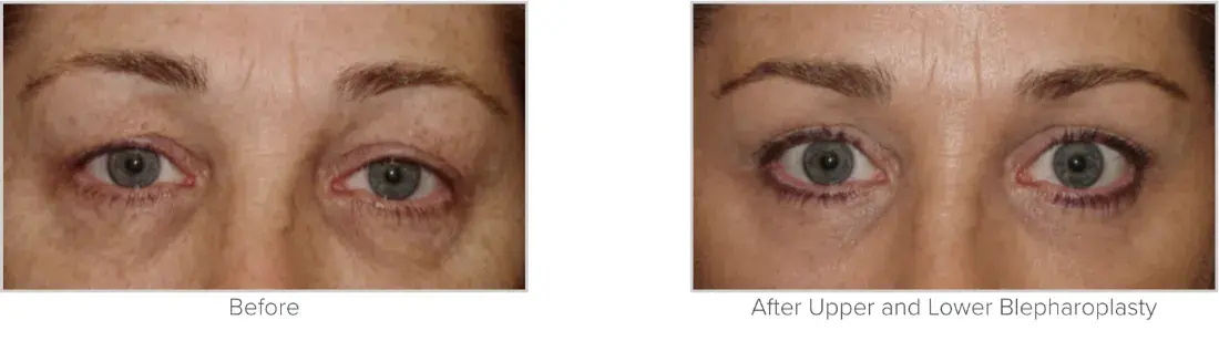 Texas Facial Aesthetics result — Frisco, TX