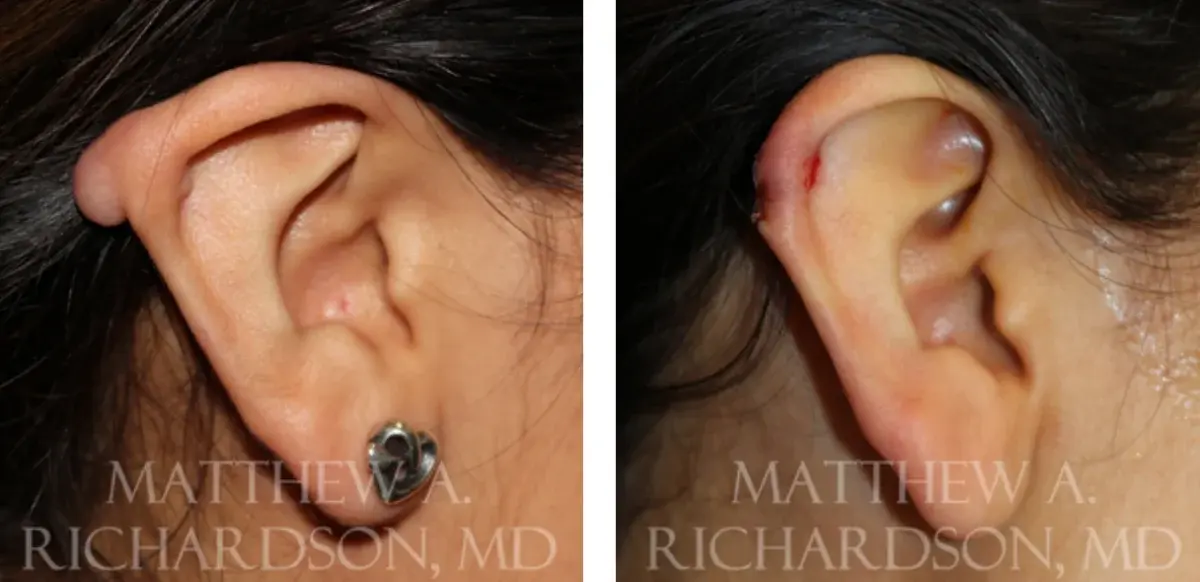 Texas Facial Aesthetics result — Frisco, TX