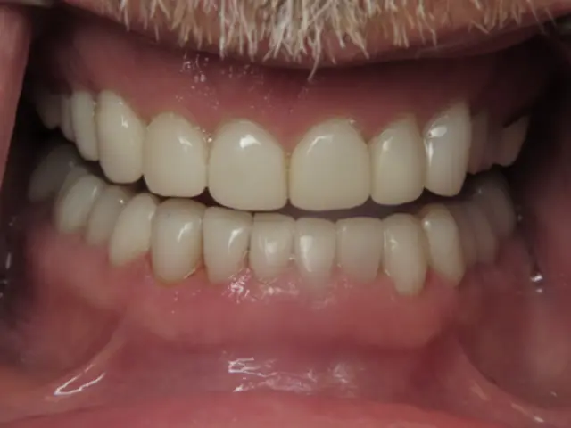 Dean Cosmetic Dentistry smile makeover after — Knoxville, TN