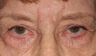 Klapper Eyelid & Facial Plastic Surgery provider photo