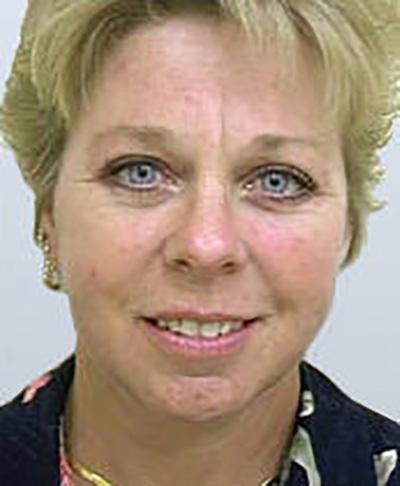 Maan Kattash, MD, FACS facelift after — Irvine, CA