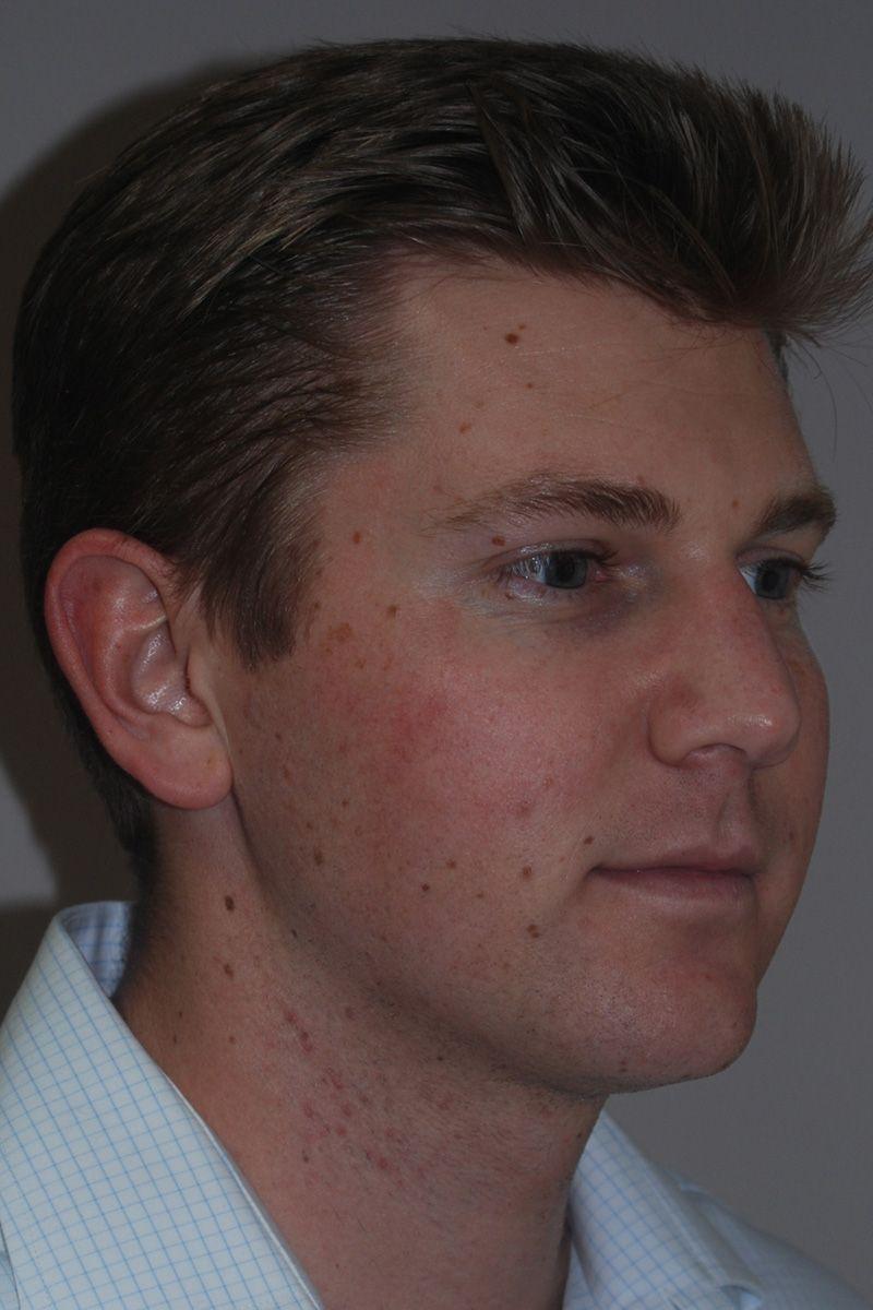 Dr. Kenneth Bermudez, MD after — San Francisco, CA