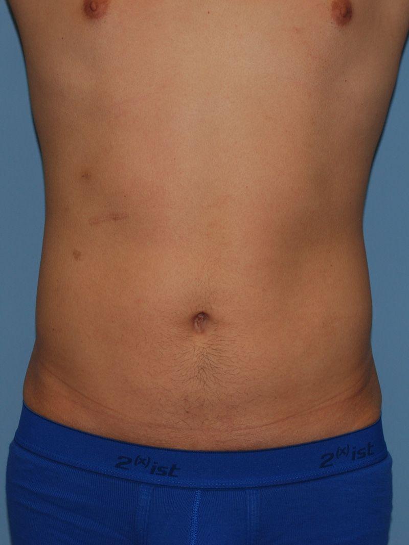 Dr. Kenneth Bermudez, MD after — San Francisco, CA