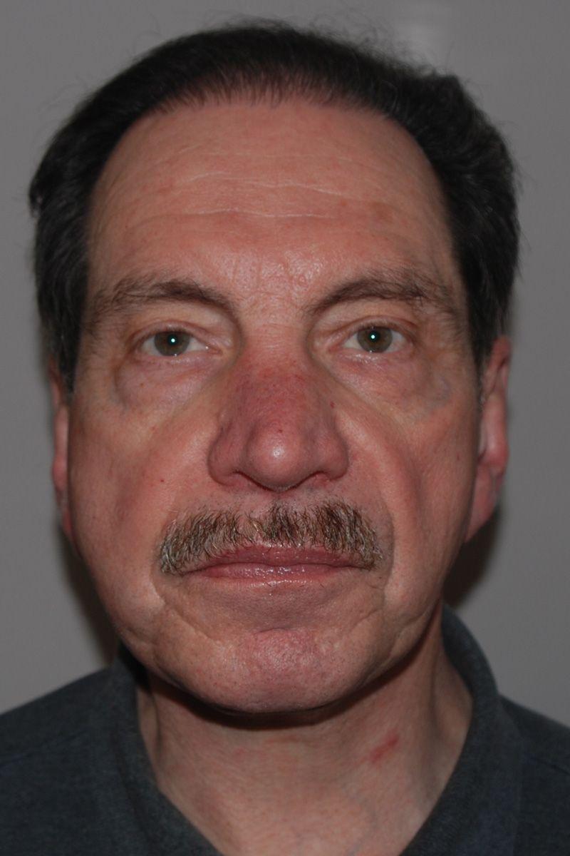 Dr. Kenneth Bermudez, MD after — San Francisco, CA