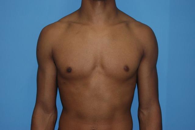 Dr. Kenneth Bermudez, MD provider photo