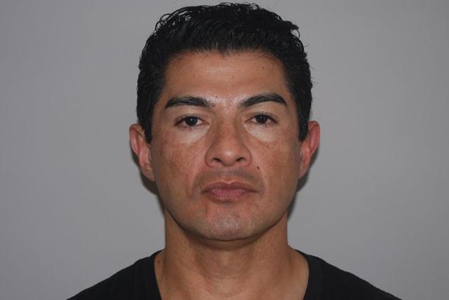 Rhinoplasty before at Dr. Kenneth Bermudez, MD in San Francisco, CA