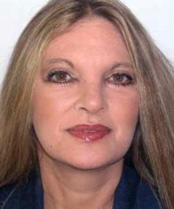 Zellner Plastic Surgery & Dr. Mordcai Blau facelift after — White Plains, NY