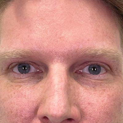 Fulcrum Aesthetics and Surgery after — Chicago, IL