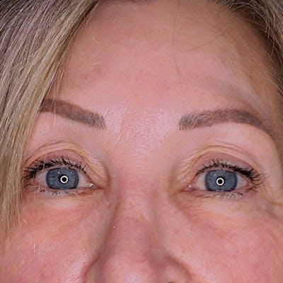 Fulcrum Aesthetics and Surgery after — Chicago, IL