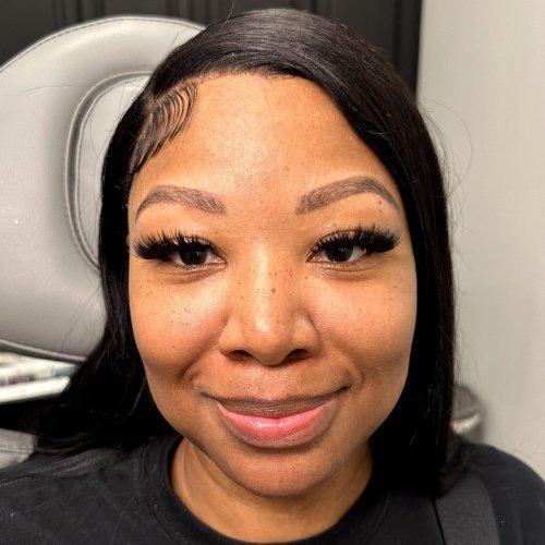 Lip Filler before at NIMS Medspa in Houston, TX