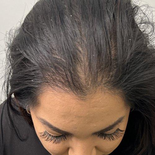 NIMS Medspa after — Houston, TX