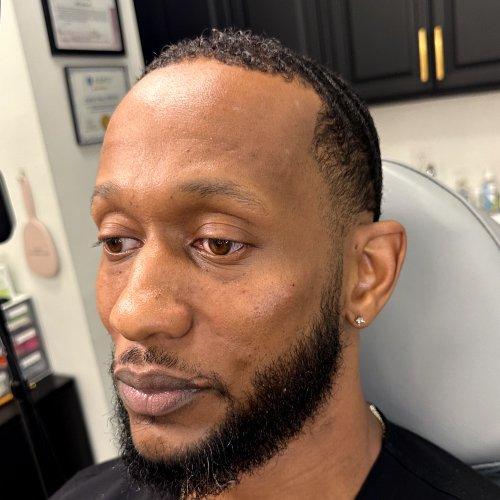NIMS Medspa after — Houston, TX